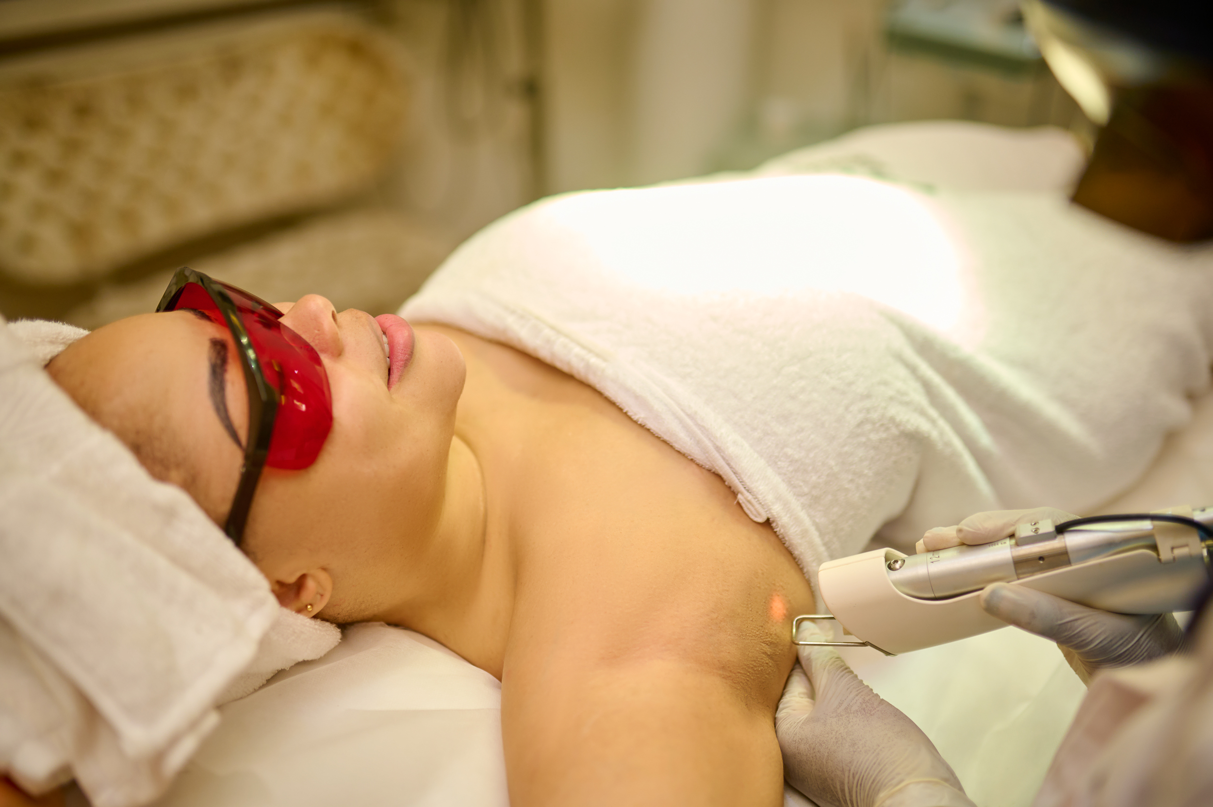 A client having a Laser Hair Removal Under-arm